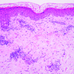 pathology of the skin