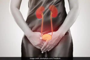 Urinary Tract Infection (UTI): Causes, Symptoms, Risk Factors and Preventive Measures - HomeoHeals