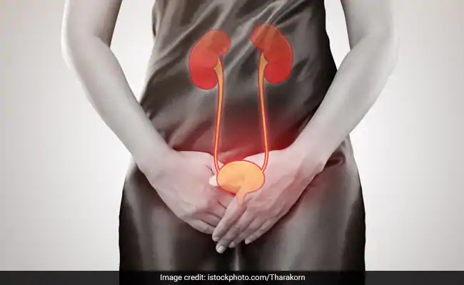 Urinary Tract Infection (UTI): Causes, Symptoms, Risk Factors and Preventive Measures - HomeoHeals